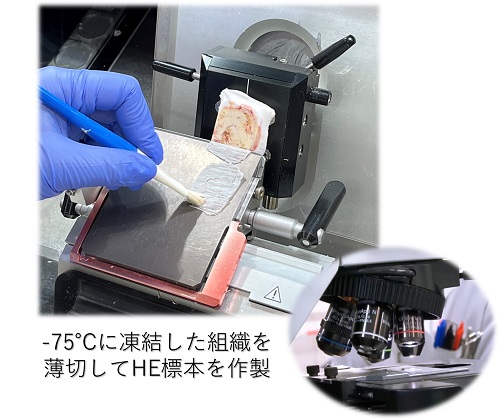 術中迅速診断